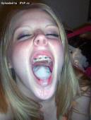 Women wearing braces pics freegallery19-Phá»¥ ná»¯ Ä‘eo niá»ng rÄƒng miá»…n phÃw6vunw70oo.jpg