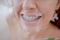 Vanna Bardot Oral Orthodontics 242 pics 1620x1080  l6wux1diqf