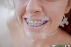 Vanna Bardot Oral Orthodontics 242 pics 1620x1080  f6wux1eobp