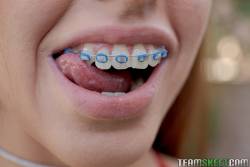 Vanna Bardot Oral Orthodontics 242 pics 1620x1080  g6wuxfgpeo