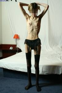 EXTREME-Skinny-Anorexic-Janine-1-e7btsdegpd.jpg