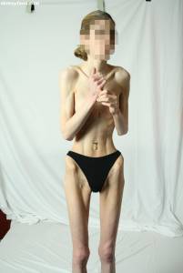 EXTREME-Skinny-Anorexic-Janine-1-t7btsft4ul.jpg
